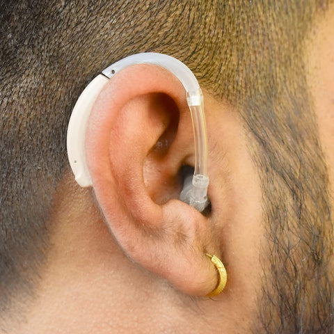 Signia Fast P Behind-The-Ear (BTE) Hearing Aid